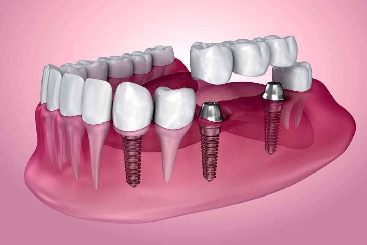 مرکز دندانپزشکی تاج