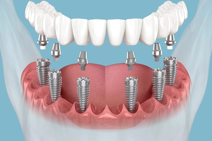 دکتر زکریا شیر بیگی
