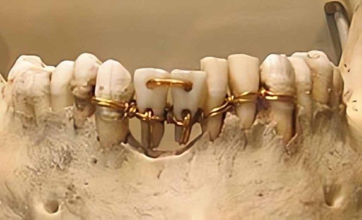 دکتر صادق آقاجری متخصص ایمپلنت دندان