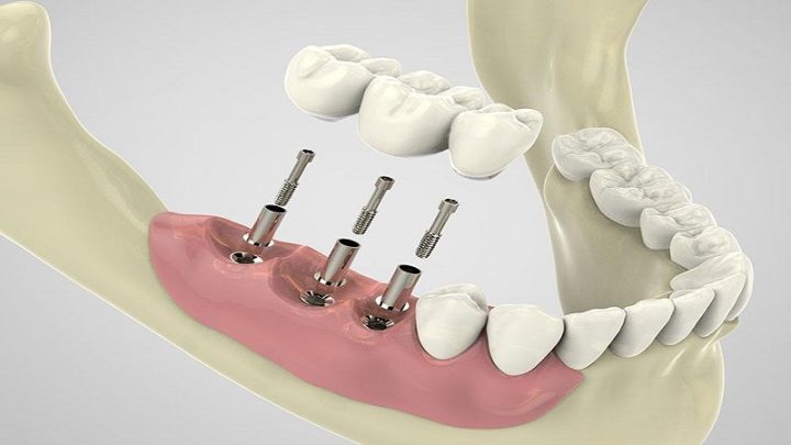 دکتر علیرضا خدیوی