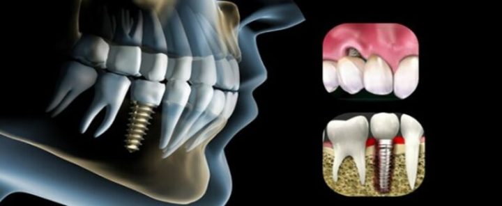مرکز دندانپزشکی موریتا