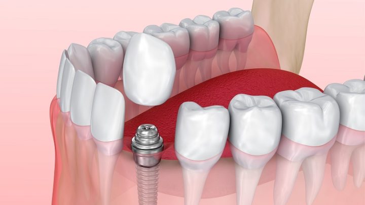 مرکز دندانپزشکی آیریک
