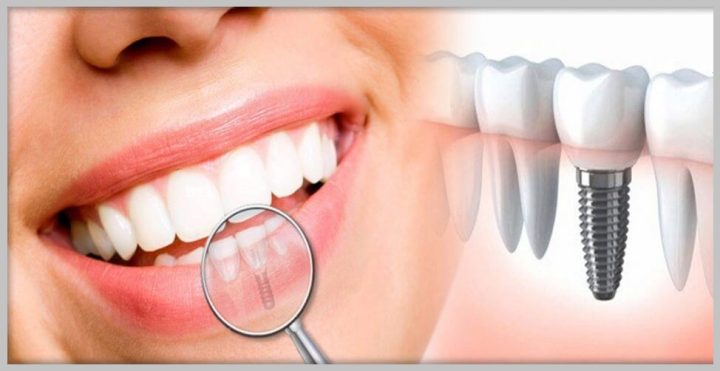 مرکز دندانپزشکی آیریک