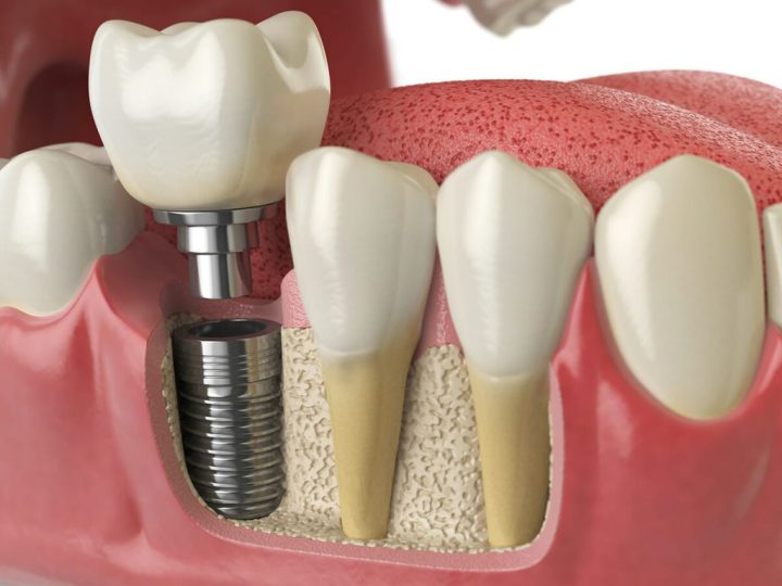 مرکز دندانپزشکی آیریک